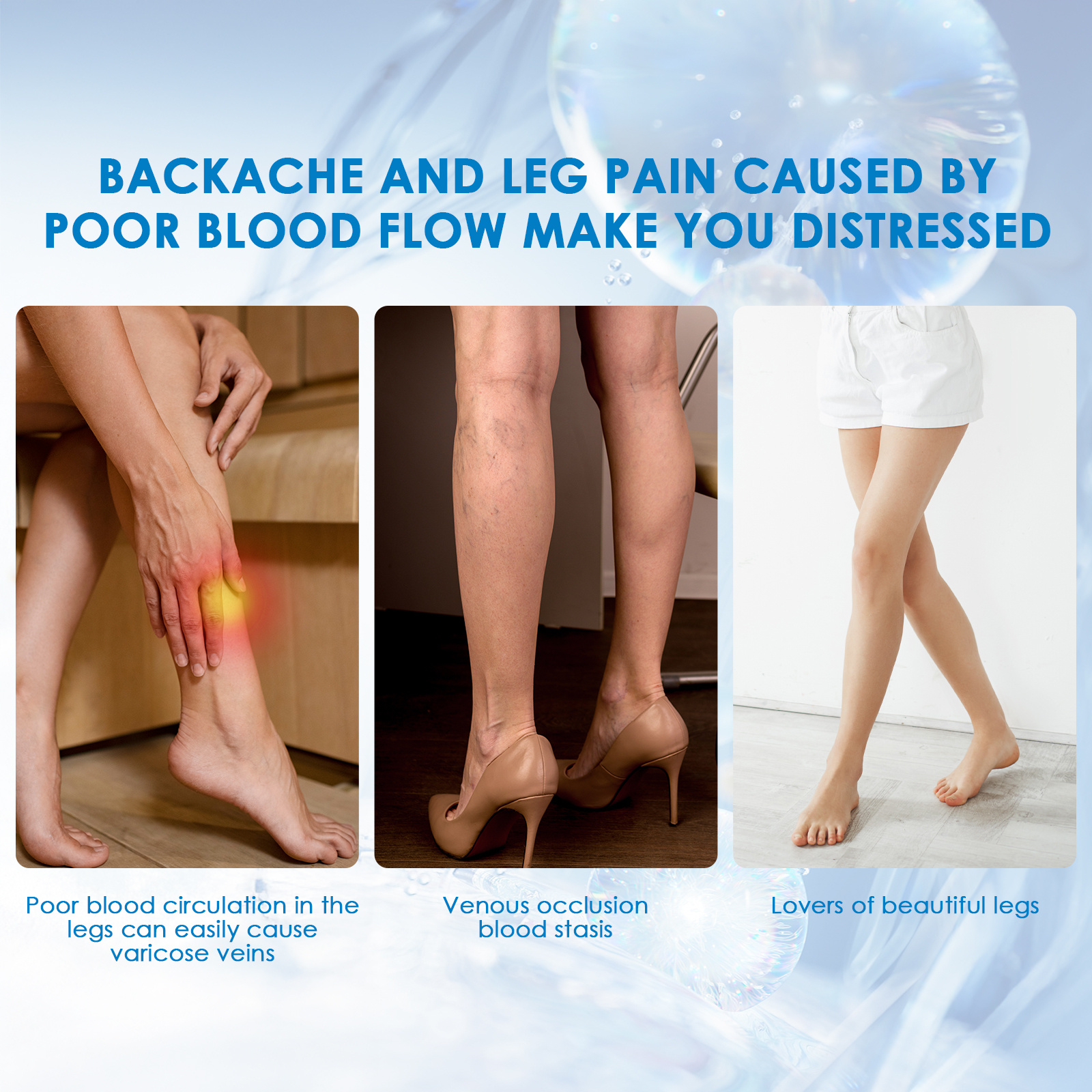 30ml Varicose Vein Spray Multi-Purpose Knee And Leg Care Spray Promote Blood Circulation - Image 2
